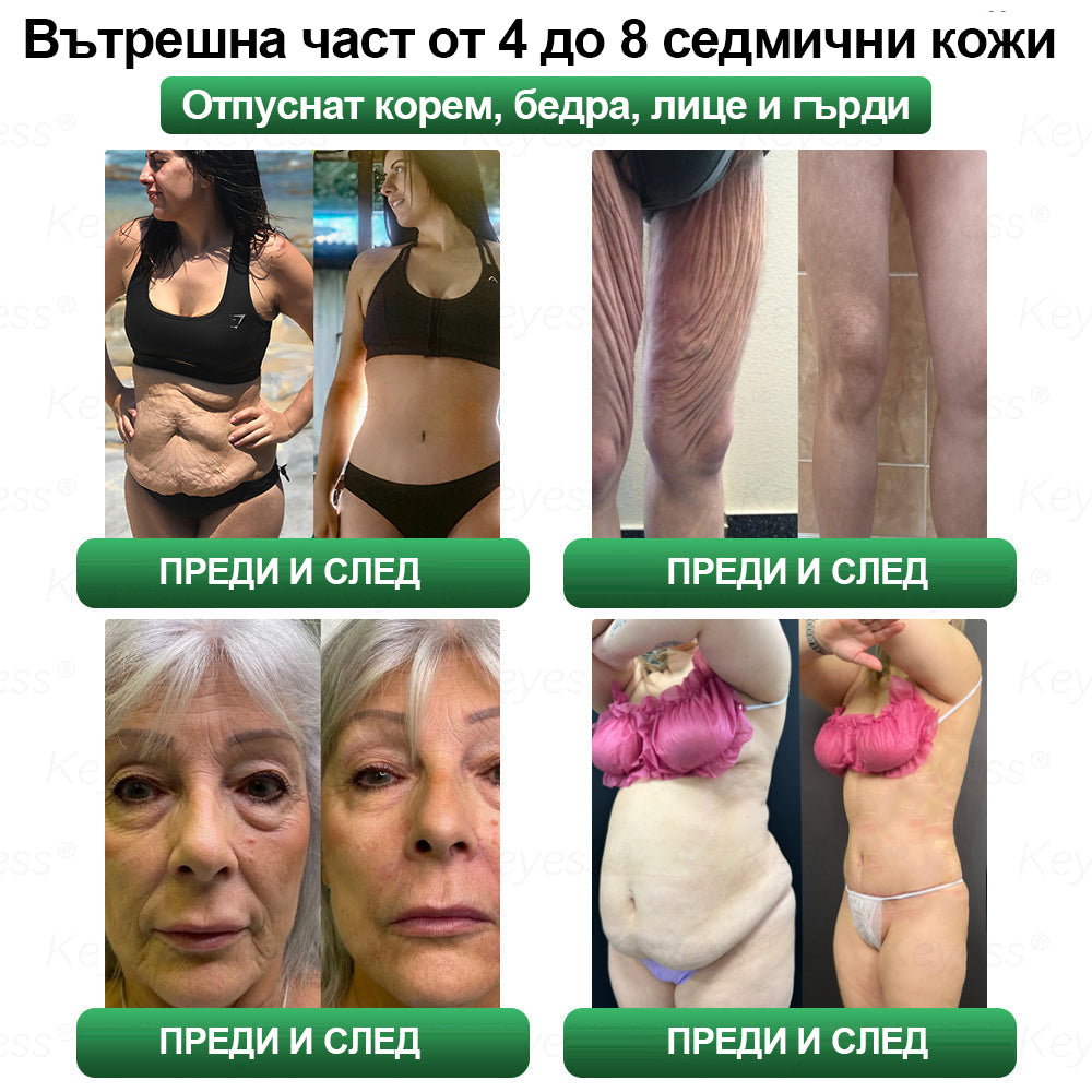 【Още 30% отстъпка! Само 5 минути】 Кейес® GLP-1 & Matrixyl 3000 Слимящи и Здраве Капки (Само една доза дневно — видими резултати само за 7 дни)  За затлъстяване, сърдечно-съдова здраве, диабет, сънна апнея, ставни проблеми и други