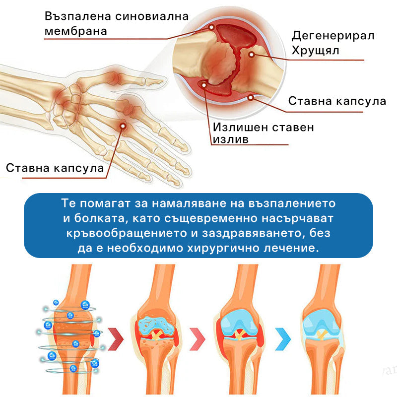 【Още 30% отстъпка! Само 5 минути】𝖯𝗂𝖼𝗱𝗼® BPC-157 Крем за лекуване на ставите🦴Лекува артрит, невропатия, ревматизъм, спортни травми и др.