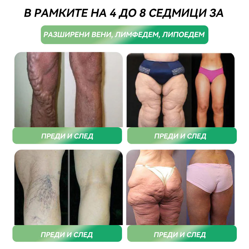 Препоръчано от над 100 000 души| официален магазин | 𝑆𝑇𝐷𝐸𝐼®  𝐺𝐿𝑃-1 Отслабване Орален разтвор - Затлъстяване, сърдечно-съдови заболявания, диабет, сънна апнея, проблеми със ставите и други